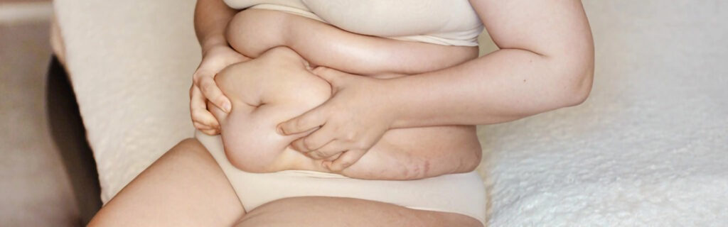 Chirurgia Bariatrica Parma